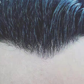 Replacement hair