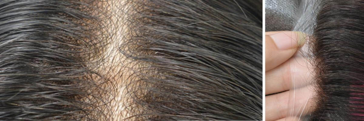 thin skin hairpiece