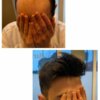 hair piece for men