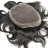 hair replacement system