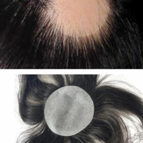 Bald Spot Hair Patch Toupee for Men