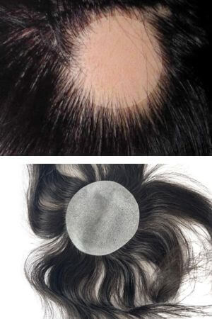 Bald Spot Hair Patch Toupee for Men