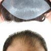 hair patch for men