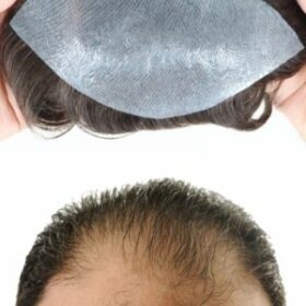Thin Skin Hairline Patch For Men