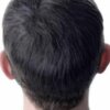 Hair Patch Toupee for Men