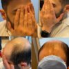 lace front silk top hair system for men