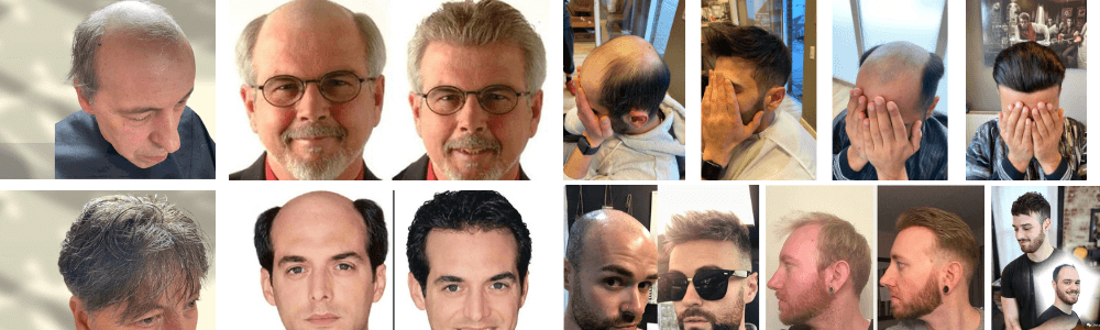 men's toupee