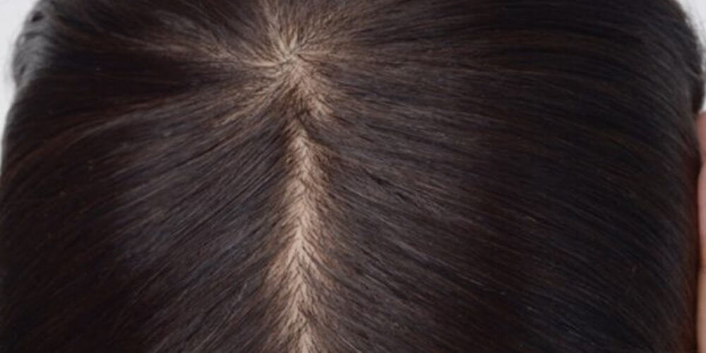 silk top toupee