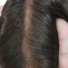 french lace hair replacement system