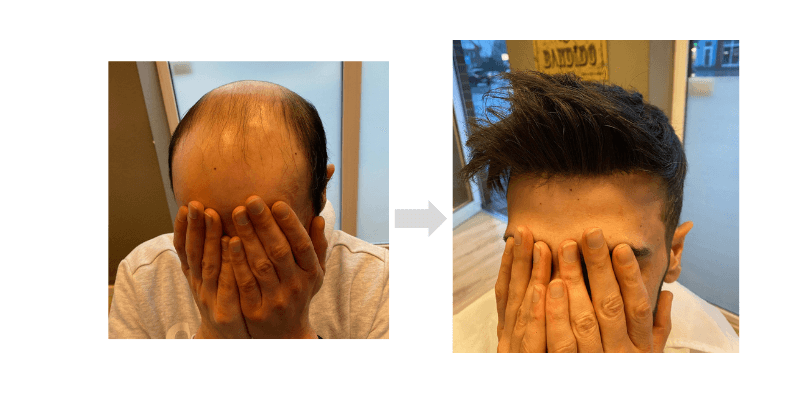toupees men's toupee