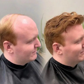 men's wig for baldness hair system lace