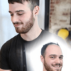 men's hair system