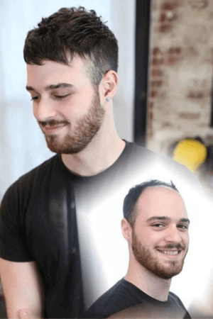 men's hair system