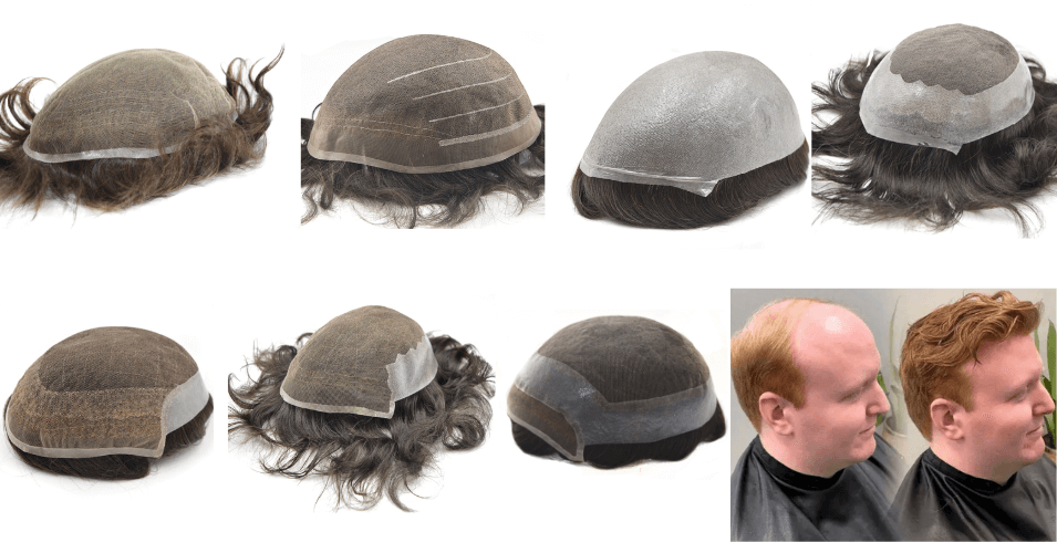 best hair systems for men, Non-Surgical Hair Replacement System, Men’s Wigs for Baldness, Lace Hair System for Men, Skin Base Hair System