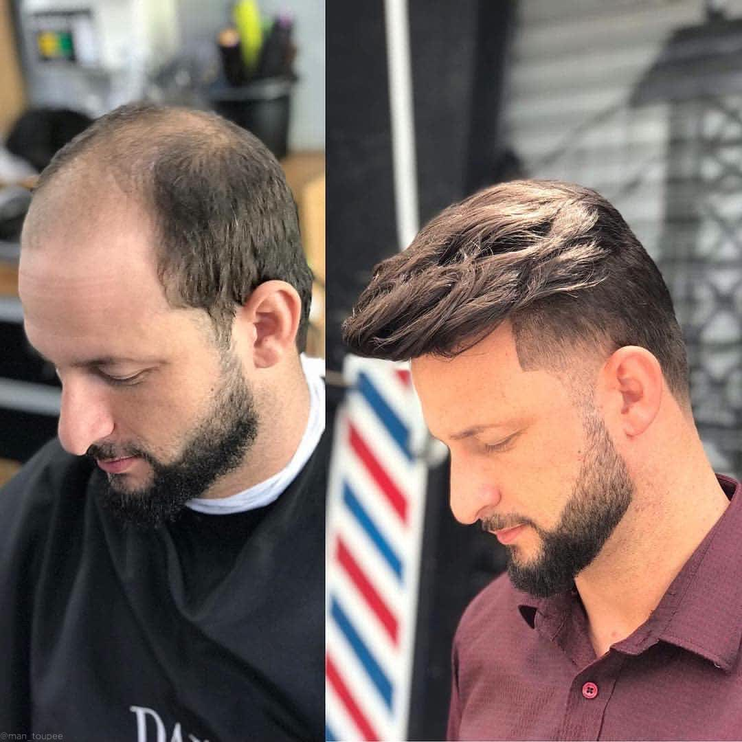 hair replacement studio style
