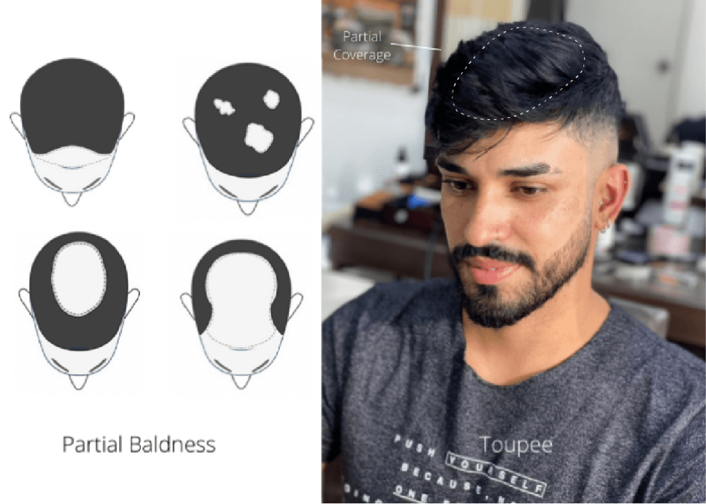 wig vs toupee