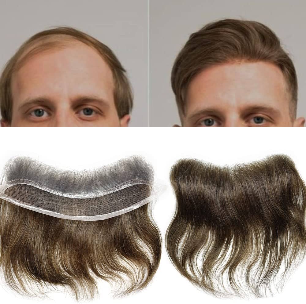 magic pixie topper for men