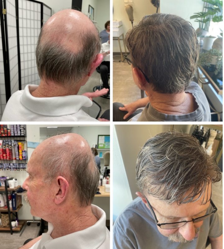 hair replacement kansas city HairNotion