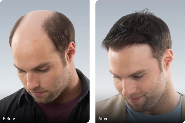 men's hair club HairNotion