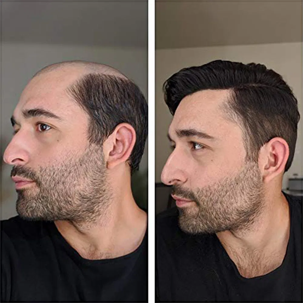 wig front