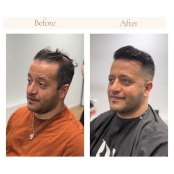 savant hair replacement