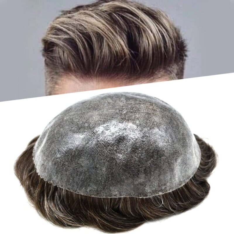 hair replacement for receding hairline HairNotion