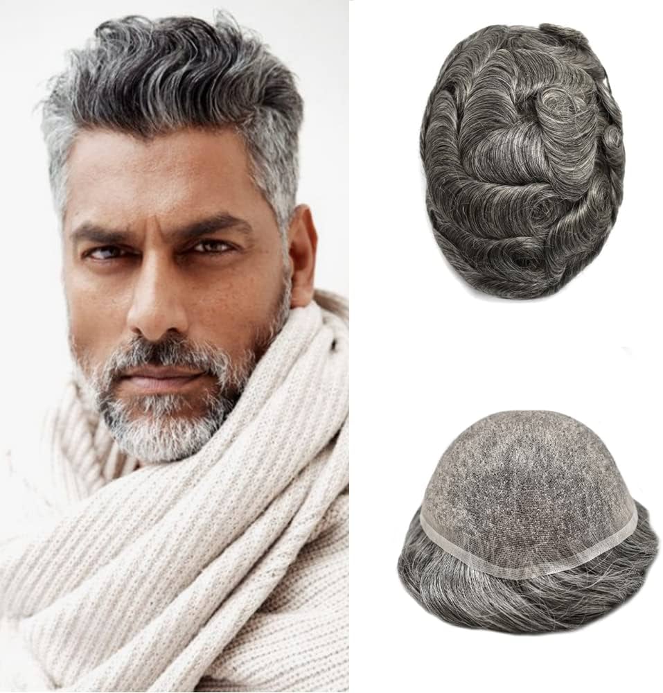 hair replacement for receding hairline