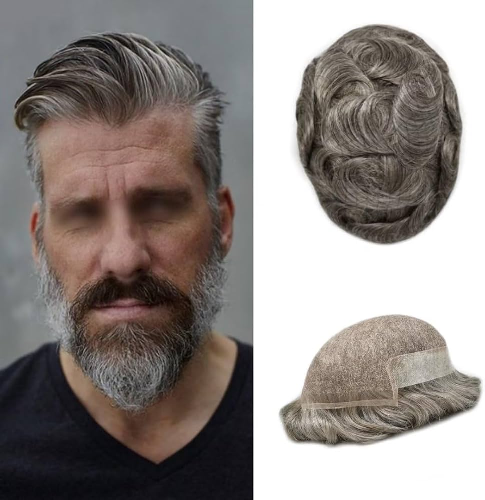 hair replacement for receding hairline