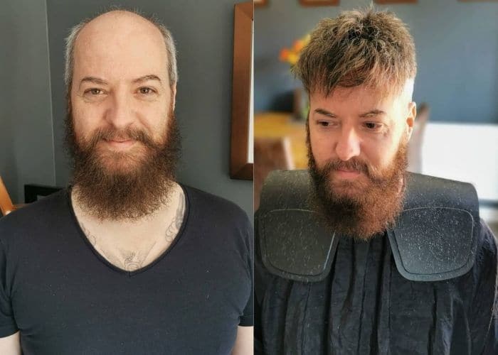 bad toupees