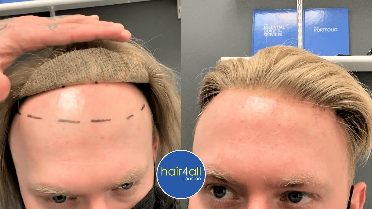 men's hairstyles receding hairline