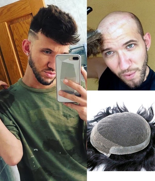 how long does a toupee last