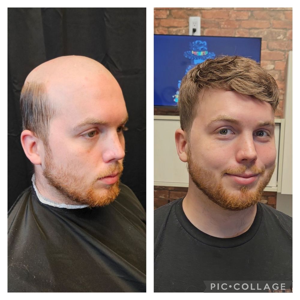 hair replacement detroit