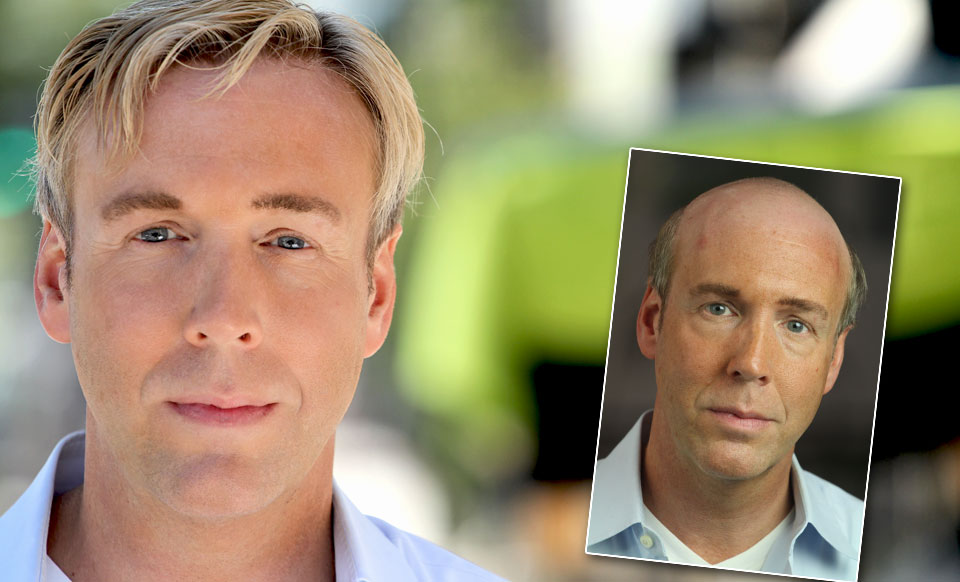 hair replacement portland oregon