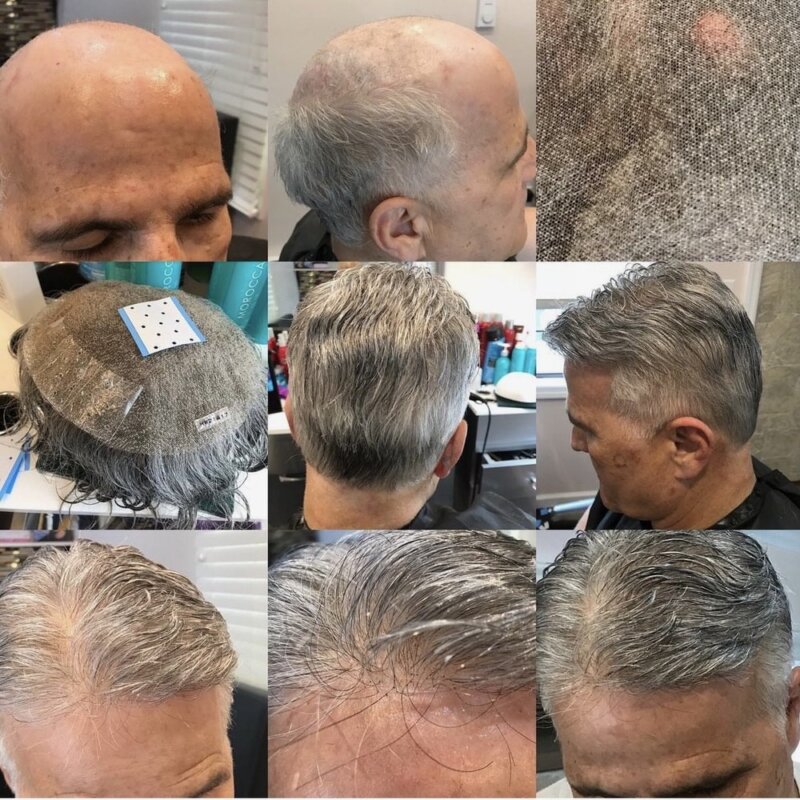 hair replacement nyc HairNotion
