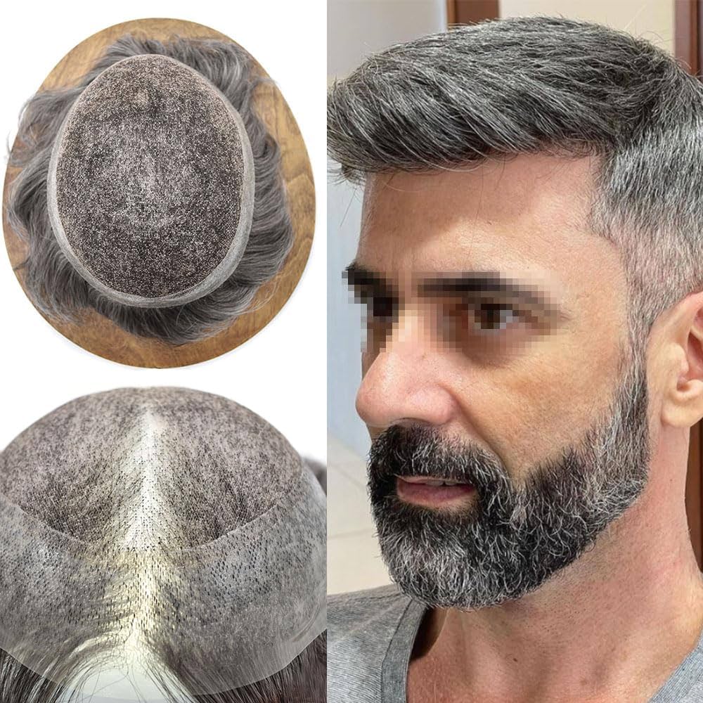 hair replacement nyc