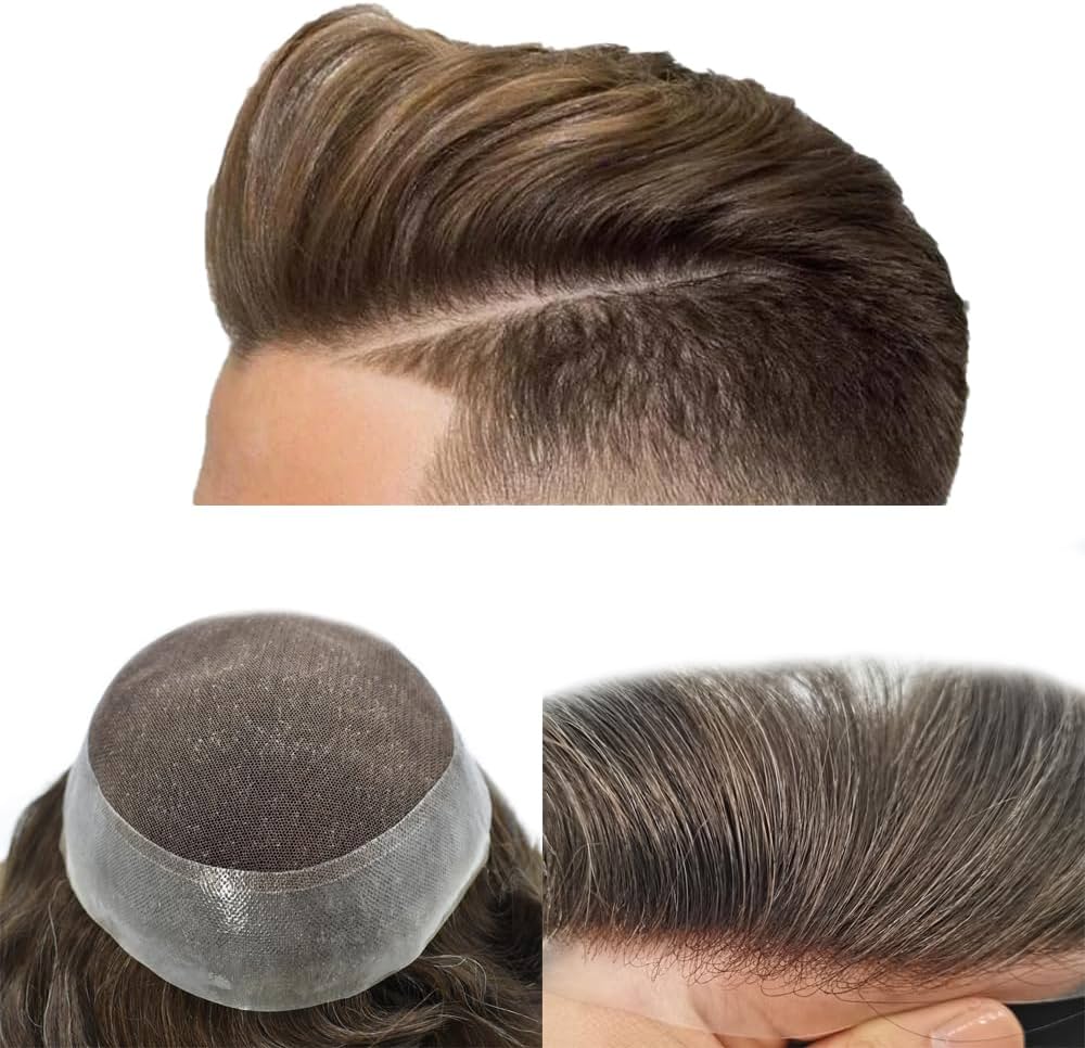 hair replacement nyc