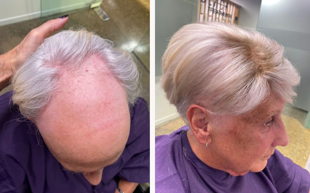 ladies hair pieces for thinning hair
