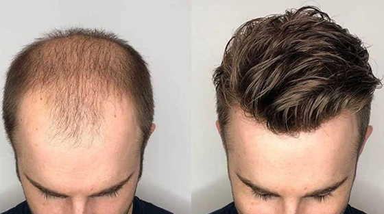 hairpiece warehouse