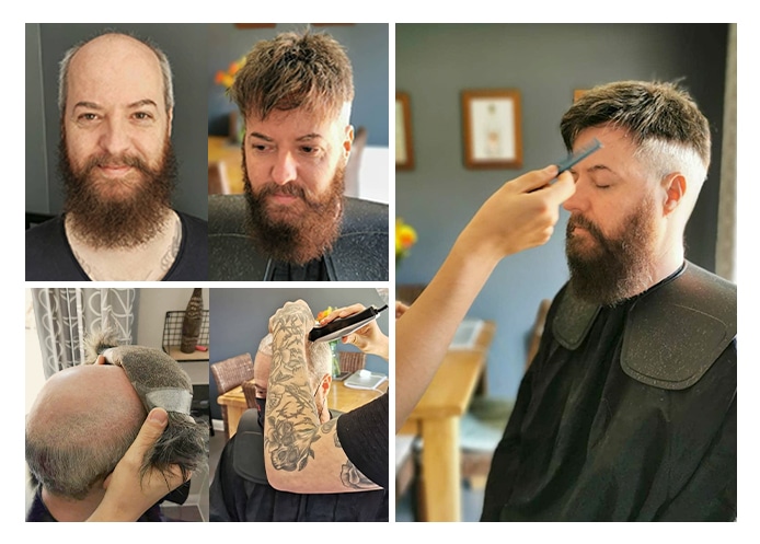 hair replacement non surgical