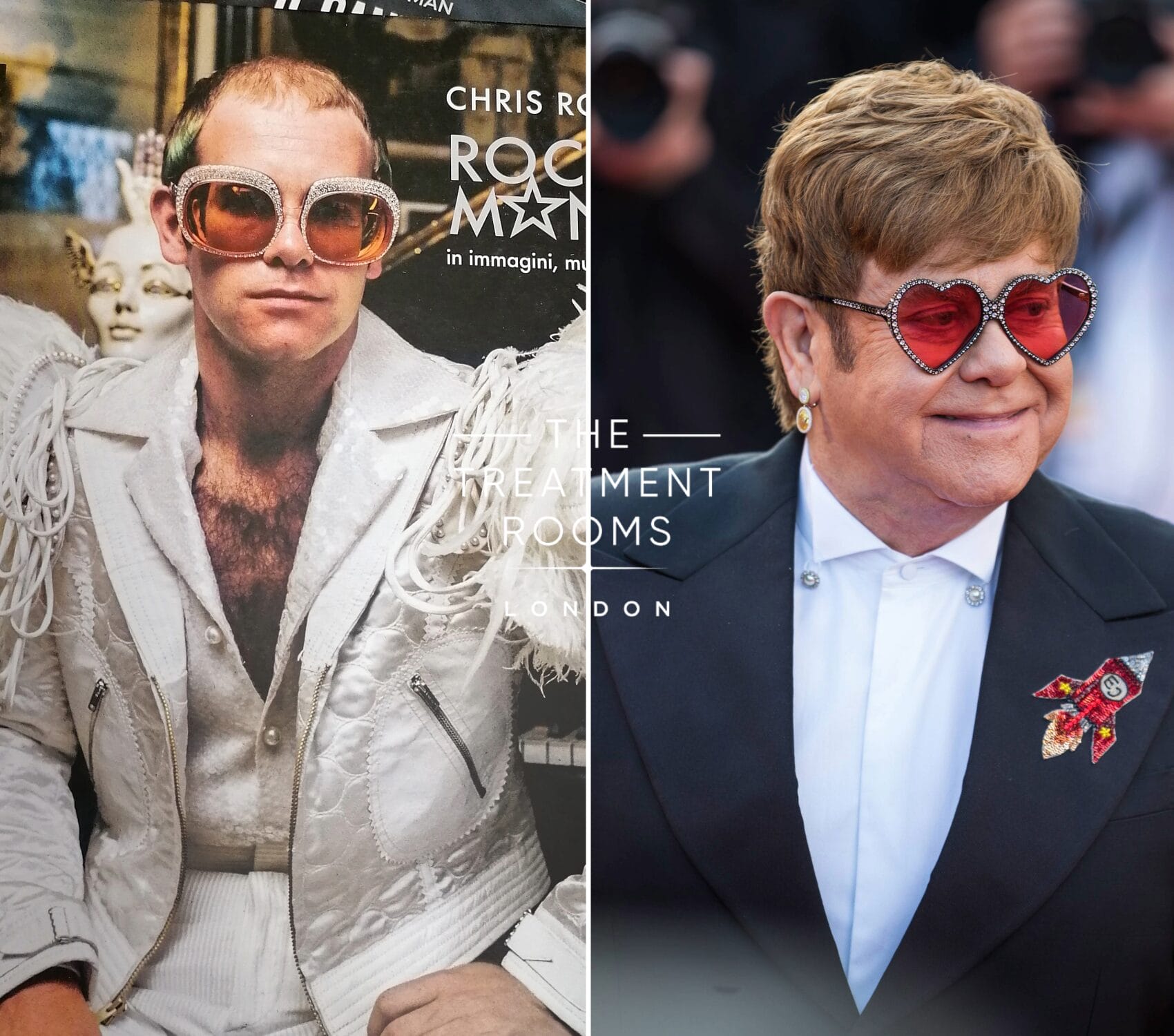 elton john toupee