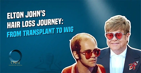 elton john toupee