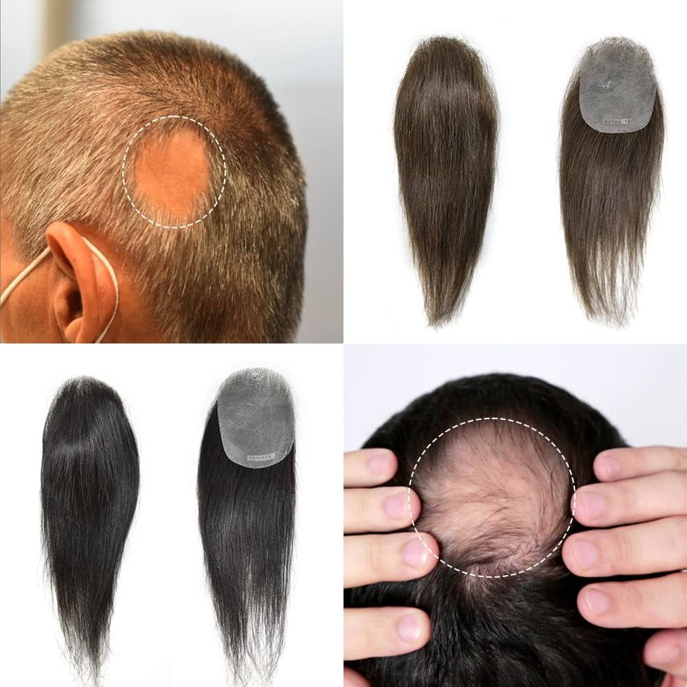 mens bald wig