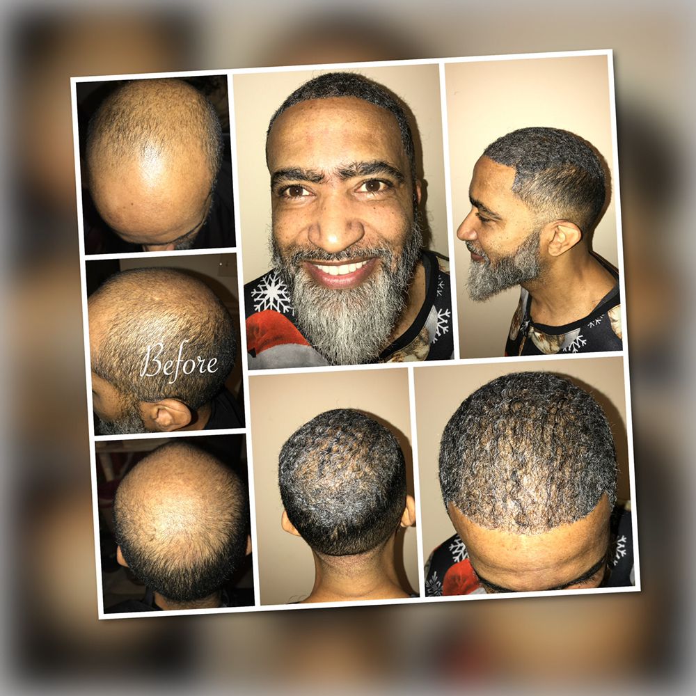 hair replacement maryland HairNotion