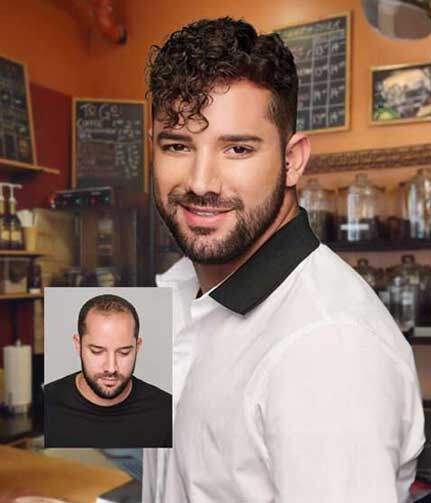 hair replacement maryland