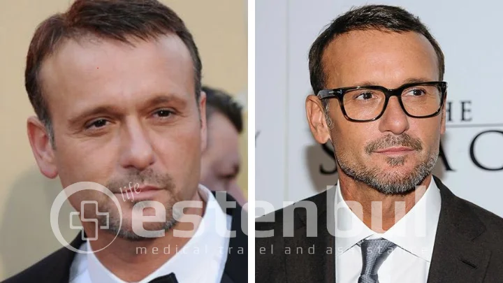 tim mcgraw toupee
