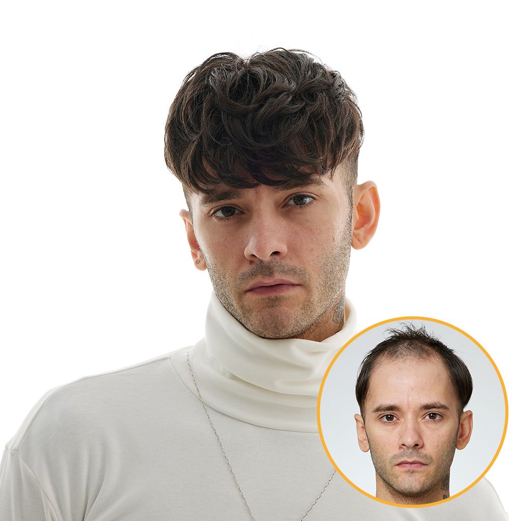 tim mcgraw toupee