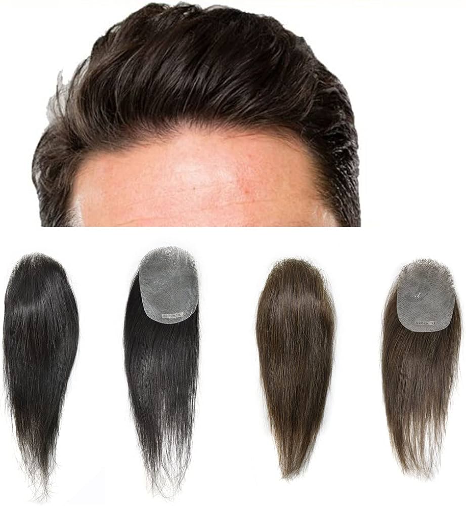 hair patch for women