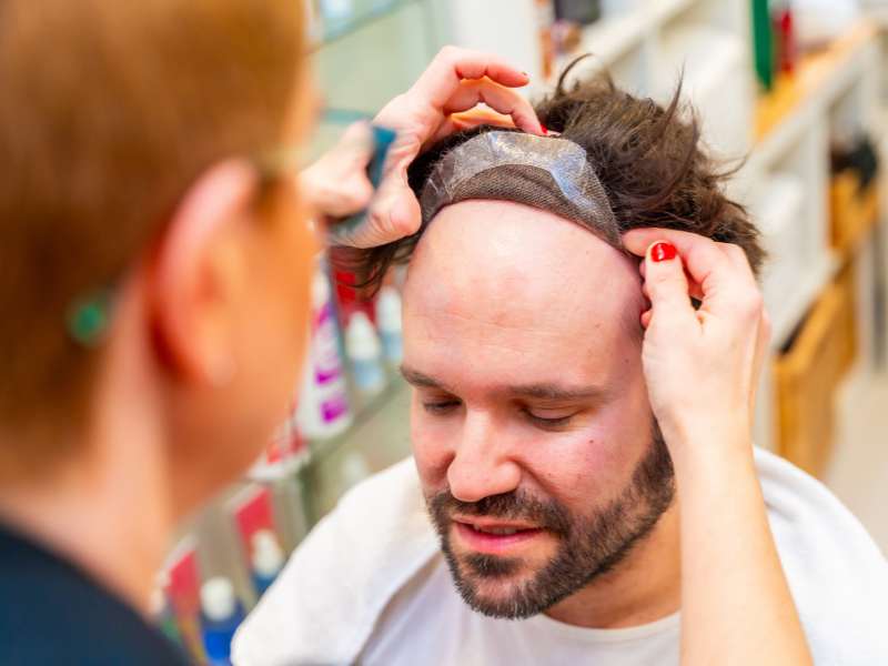 wigs for chemotherapy patients