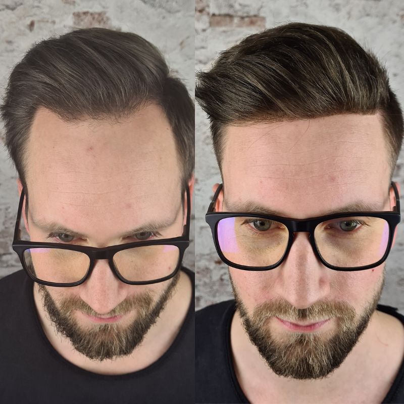 fusion hair extensions cost