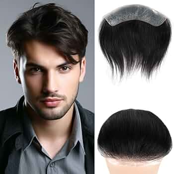 hairpiece for receding hairline